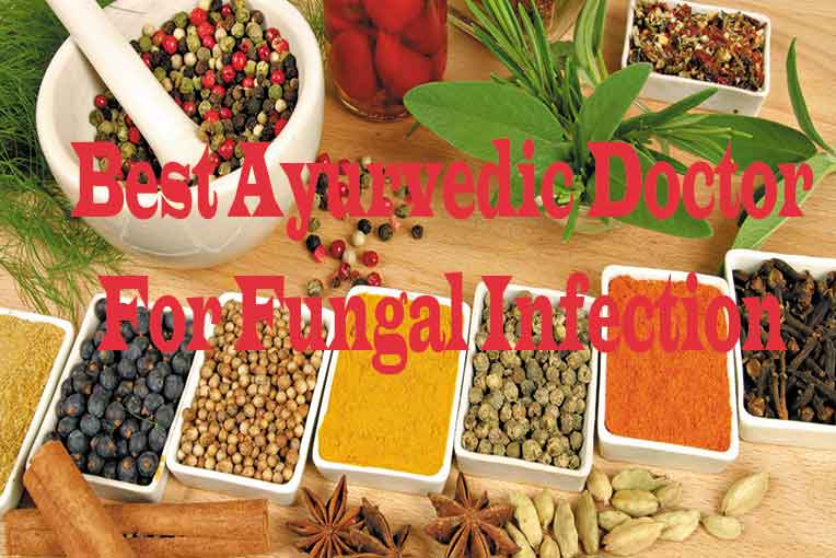 best-ayurvedic-doctor-for-fungal-infection