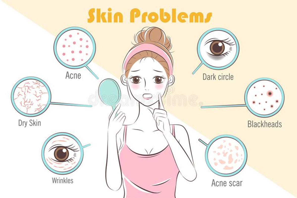 Skin Problems